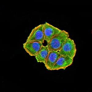 NAA10 / ARD1A Antibody (clone 3G3E9)
