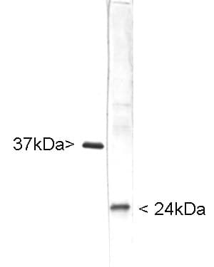 IHC-plus™ Polyclonal Chicken anti-Human UCHL1 / PGP9.5 Antibody (IHC, IF, WB)