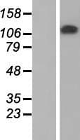 ZKSCAN2 Protein (Over-Expression Lysate Myc-DDK (Flag))