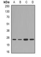 Polyclonal Rabbit anti-Human FAM173B Antibody (WB)