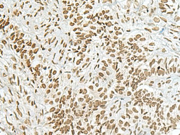 HAS1 / HAS Antibody