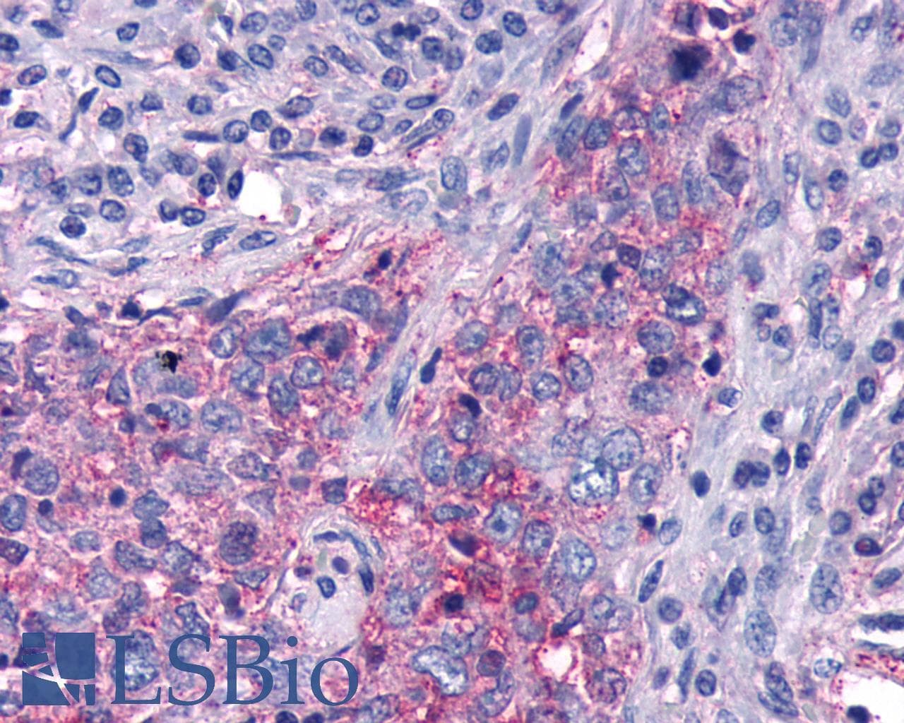 PathPlus™ FZD5 / Frizzled 5 Antibody (Cytoplasmic Domain)