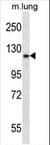 EPHA2 / EPH Receptor A2 Antibody (aa296-323)