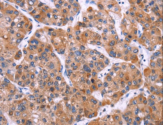 Polyclonal Rabbit anti-Human SC4MOL Antibody (IHC)