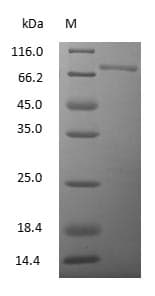 TF / Transferrin Protein (Native)