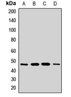 Polyclonal Rabbit anti-Human AGK Antibody (WB)