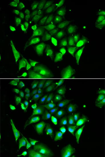 BHLHB2 / DEC1 Antibody