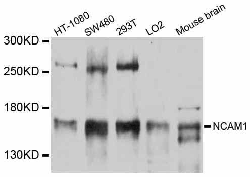 Polyclonal Rabbit anti-Human NCAM / CD56 Antibody (aa500-720, WB)