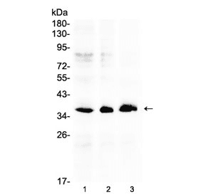 Polyclonal Rabbit anti-Human AKR1B10 Antibody (IHC, WB)
