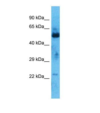 ZNF772 Antibody (aa31-80)