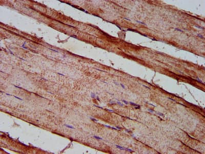 Polyclonal Rabbit anti-Human DMD / Dystrophin Antibody (IHC)
