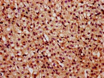 Polyclonal Rabbit anti-Human HIST1H2BN Antibody (IHC, IF)