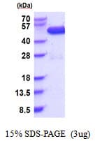 Human c-Src Kinase / CSK Protein (Recombinant His)