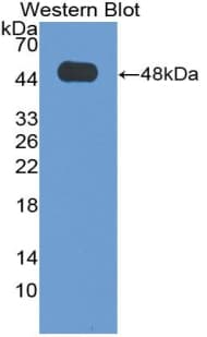 DLK1 / Pref-1 Antibody (aa24-175)