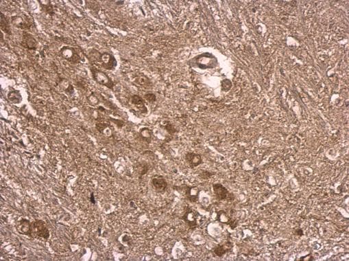 E6AP / UBE3A Antibody (aa34-422)