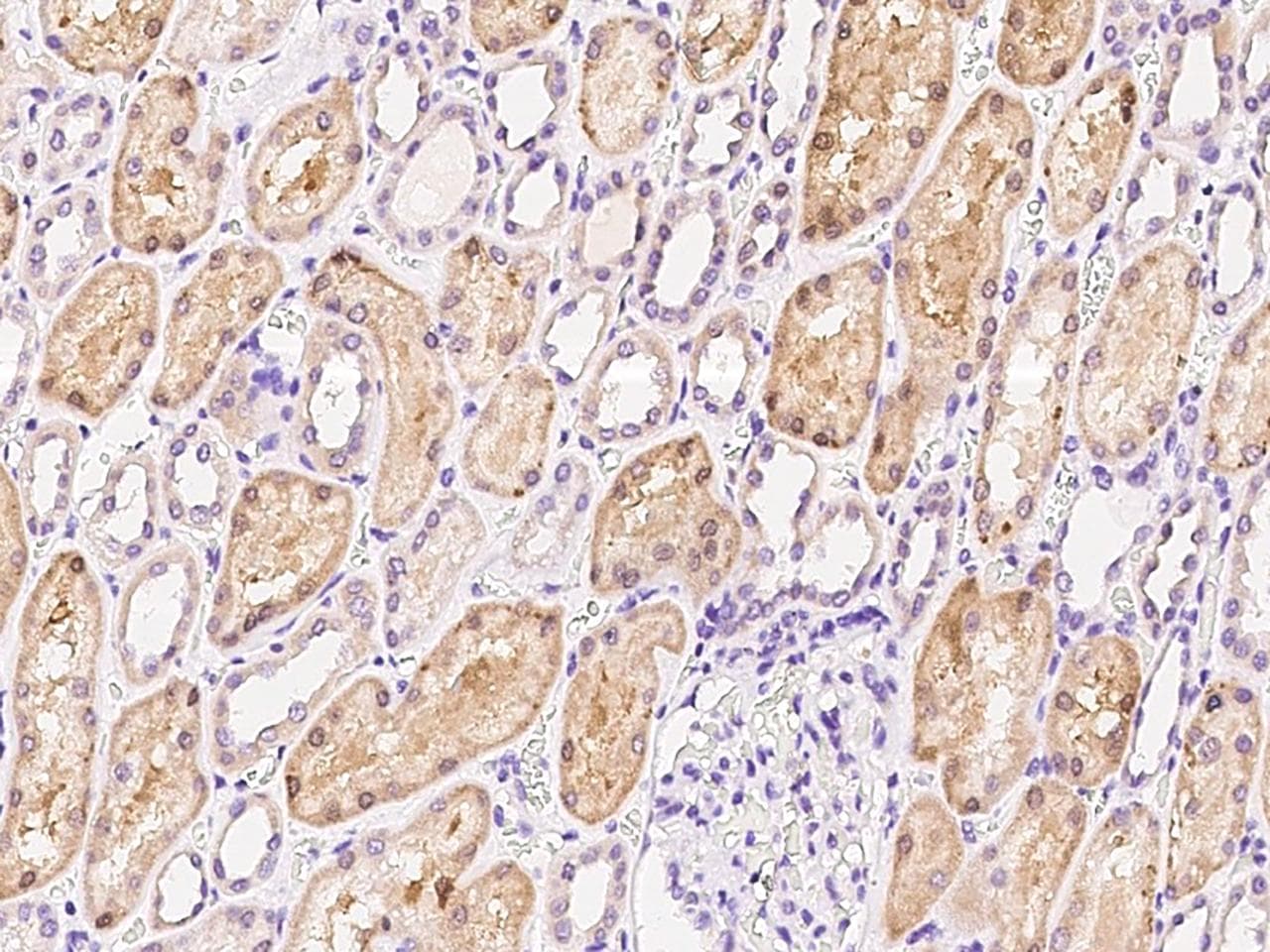 HLCS / HCS Antibody