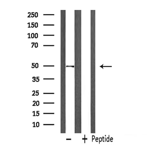 PPARD / PPAR Delta Antibody
