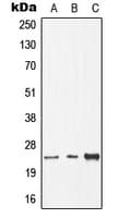 Thymidylate Kinase Antibody (N-Terminus)