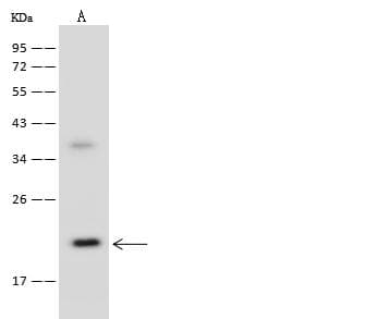 Polyclonal Rabbit anti-Human UBE2M / UBC12 Antibody (WB)