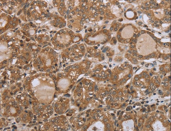 NDUFS2 Antibody