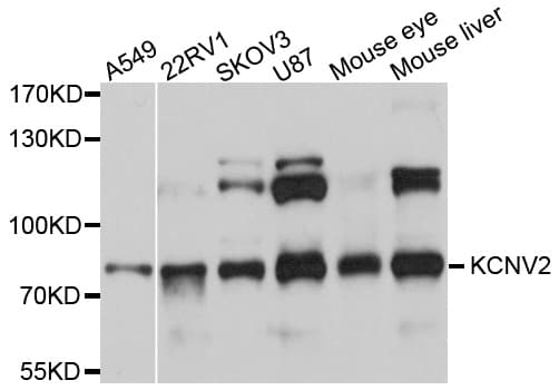Polyclonal Rabbit anti-Human KCNV2 / Kv11.1 Antibody (WB)