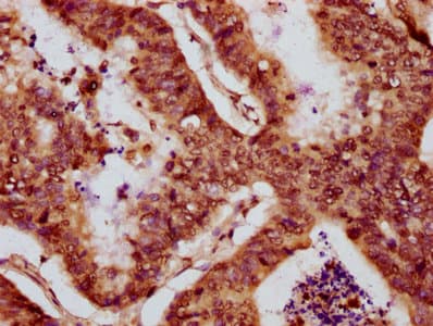 Polyclonal Rabbit anti-Human HIST1H2BN Antibody (IHC, WB)