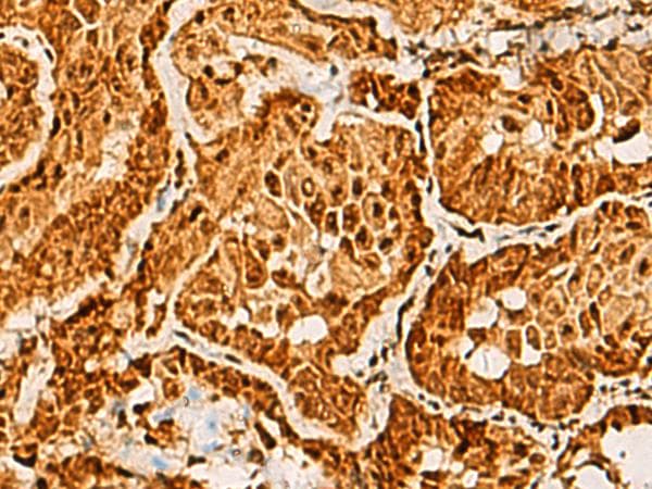 Polyclonal Rabbit anti-Human SAP30BP / HTRG Antibody (IHC)