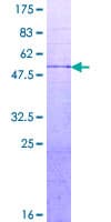 Human DUT / DUTPase Protein (Recombinant GST)