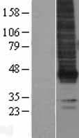 LPAR1 / LPA1 / EDG2 Protein (Over-Expression Lysate Myc-DDK (Flag))