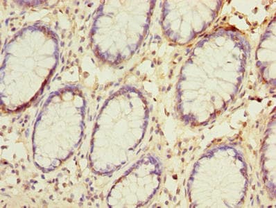 NAT2 Antibody