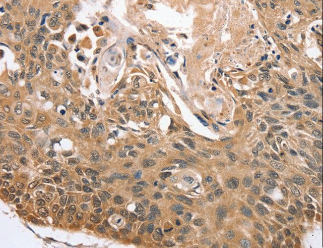 RBM38 Antibody