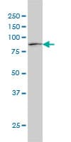 STAT1 Antibody (clone 1A8)