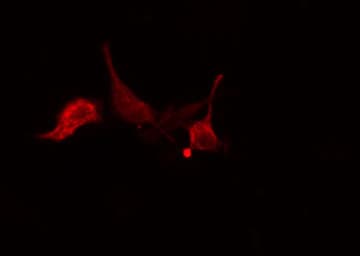 RPL15 / Ribosomal Protein L15 Antibody