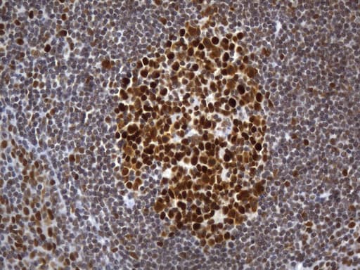 MSH2 Antibody (aa1-304, clone UMAB259)