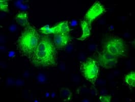 Monoclonal Mouse anti-Human PRDX4 / Peroxiredoxin 4 Antibody (clone OTI9A3, IHC, IF, WB)
