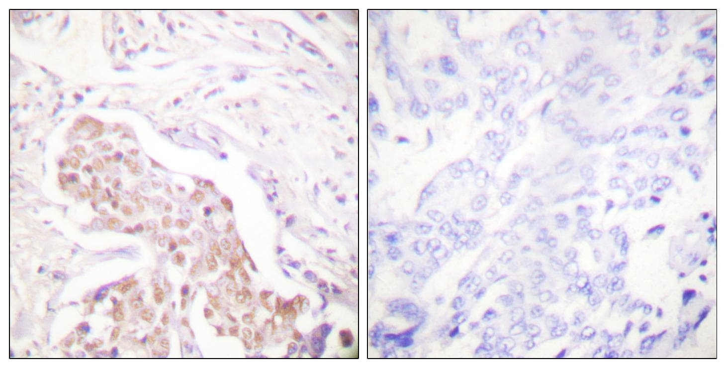 Polyclonal Rabbit anti-Human FANCD2 Antibody (phospho-Ser222, IHC, WB)