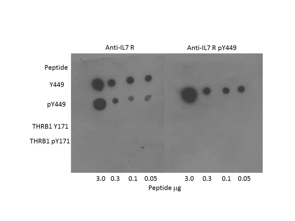 IHC-plus™ Polyclonal Rabbit anti-Human IL7R / CD127 Antibody (IHC, WB)