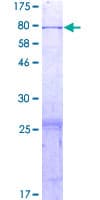 Human KIAA1826 Protein (Recombinant GST)