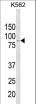 ALDH18A1 Antibody (aa176-205)
