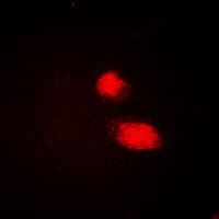 CMPK / CMPK1 Antibody (N-Terminus)