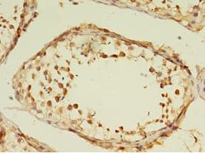 GRK4 Antibody (aa1-245)