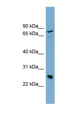 KLK5 / Kallikrein 5 Antibody (aa35-84)