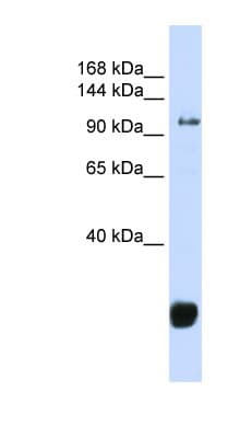 FBXO10 Antibody (aa324-373)