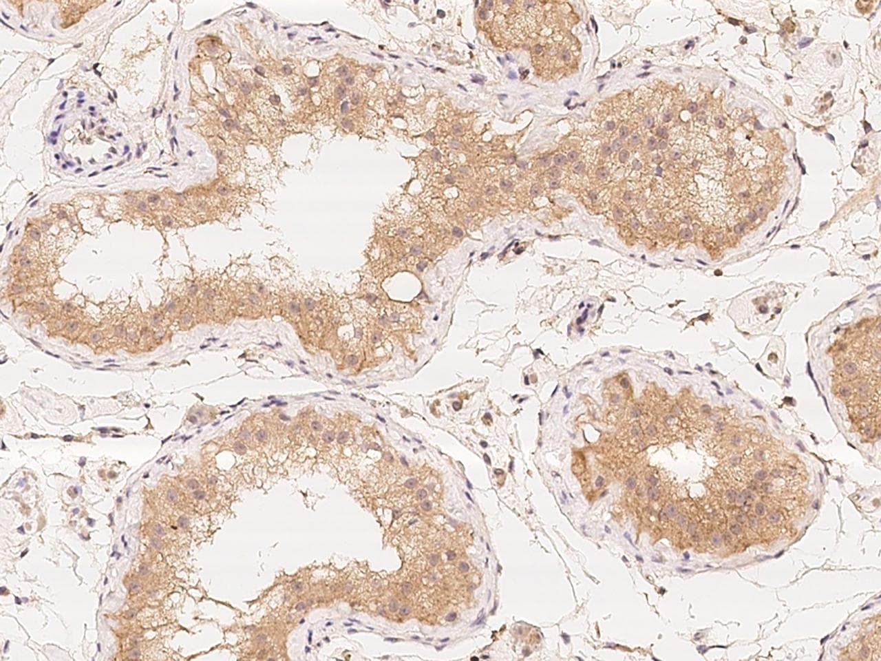 Polyclonal Rabbit anti-Human CENTG2 / AGAP1 Antibody (IHC)