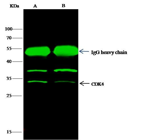 CDK4 Antibody (Preservative Free)