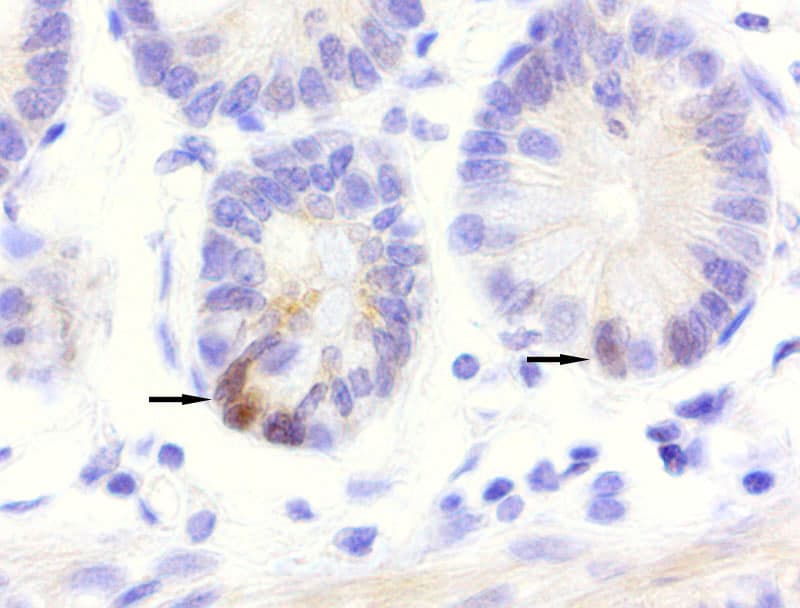 Monoclonal Mouse anti-Human GPR49 / LGR5 Antibody (clone UMAB212, aa22-543, IHC, IF, WB)