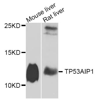 TP53AIP1 / p53 AIP1 Antibody