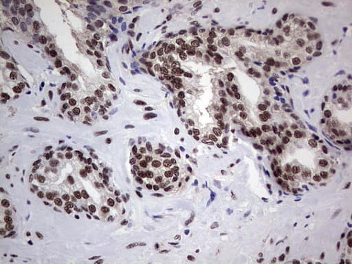 PPP1R8 / Rnase E Antibody (aa1-225, clone OTI4D5)