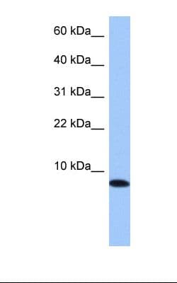 TNP1 / TP1 Antibody (C-Terminus)