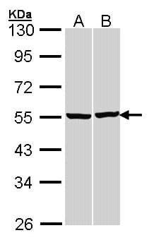 IHC-plus™ TUBB / Beta Tubulin Antibody (aa238-429)